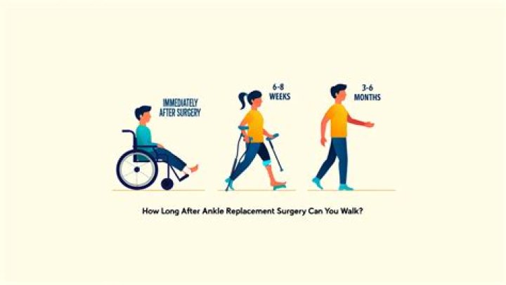 How long after ankle surgery Can you swim?