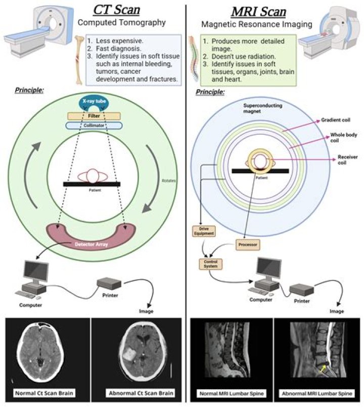 Is CAT scan the same as MRI?