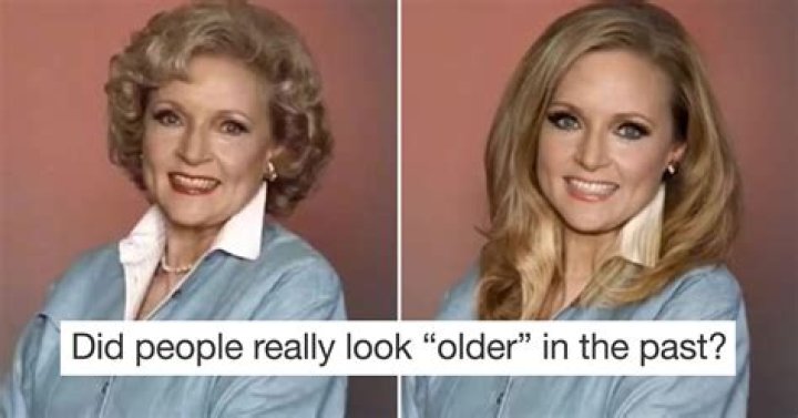 What is it called when you look older than you are?