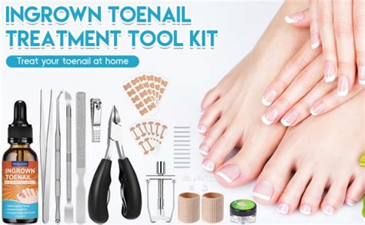Will Urgent Care remove an ingrown toenail?
